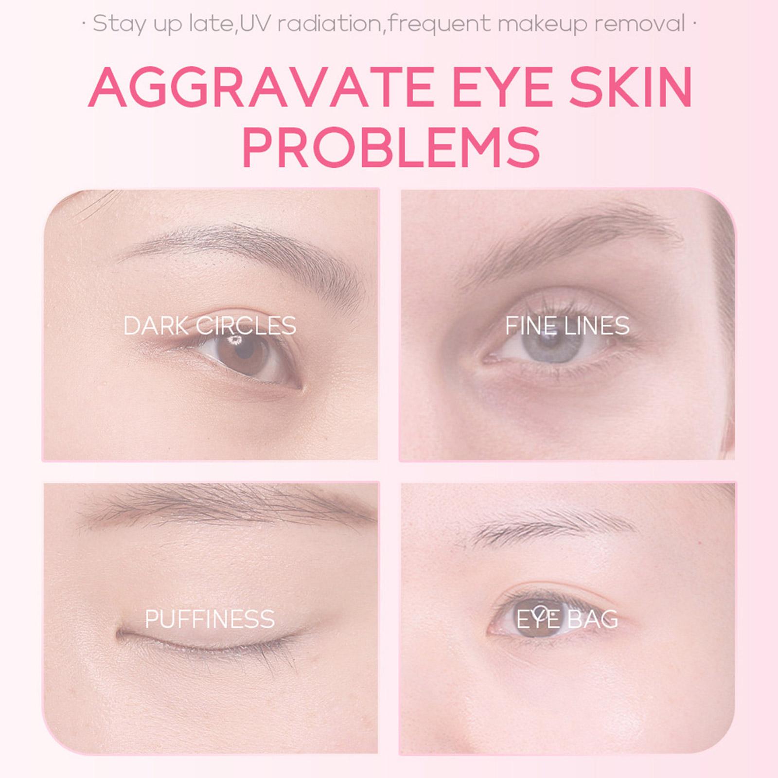 1/3/5pcs Sakura Eye Essence cr - đánh giá và giá Women Bags Under Eyes