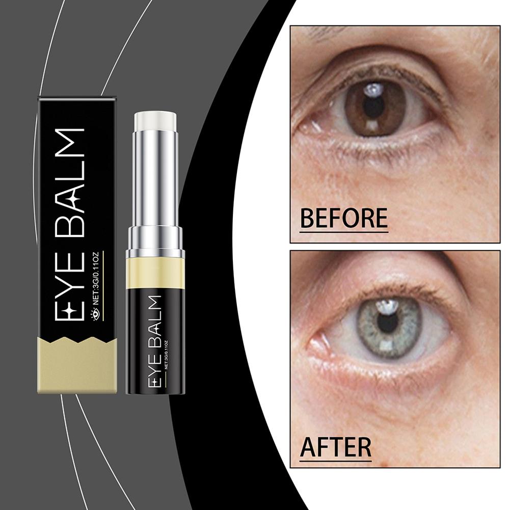 Anti-Aging Retinol Eye Cream F - đánh giá và giá Women Bags Under Eyes