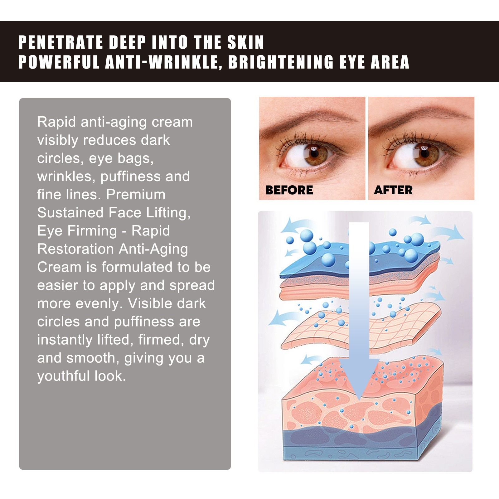 OUHOE Retinol Eye Cream Anti-W - đánh giá và giá Women Bags Under Eyes