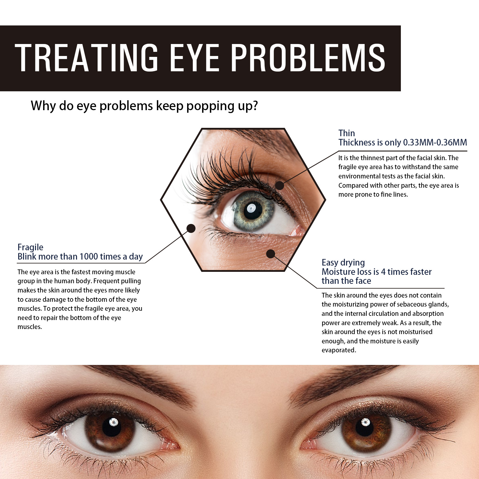 OUHOE Retinol Eye Cream Anti-W - đánh giá và giá Women Bags Under Eyes