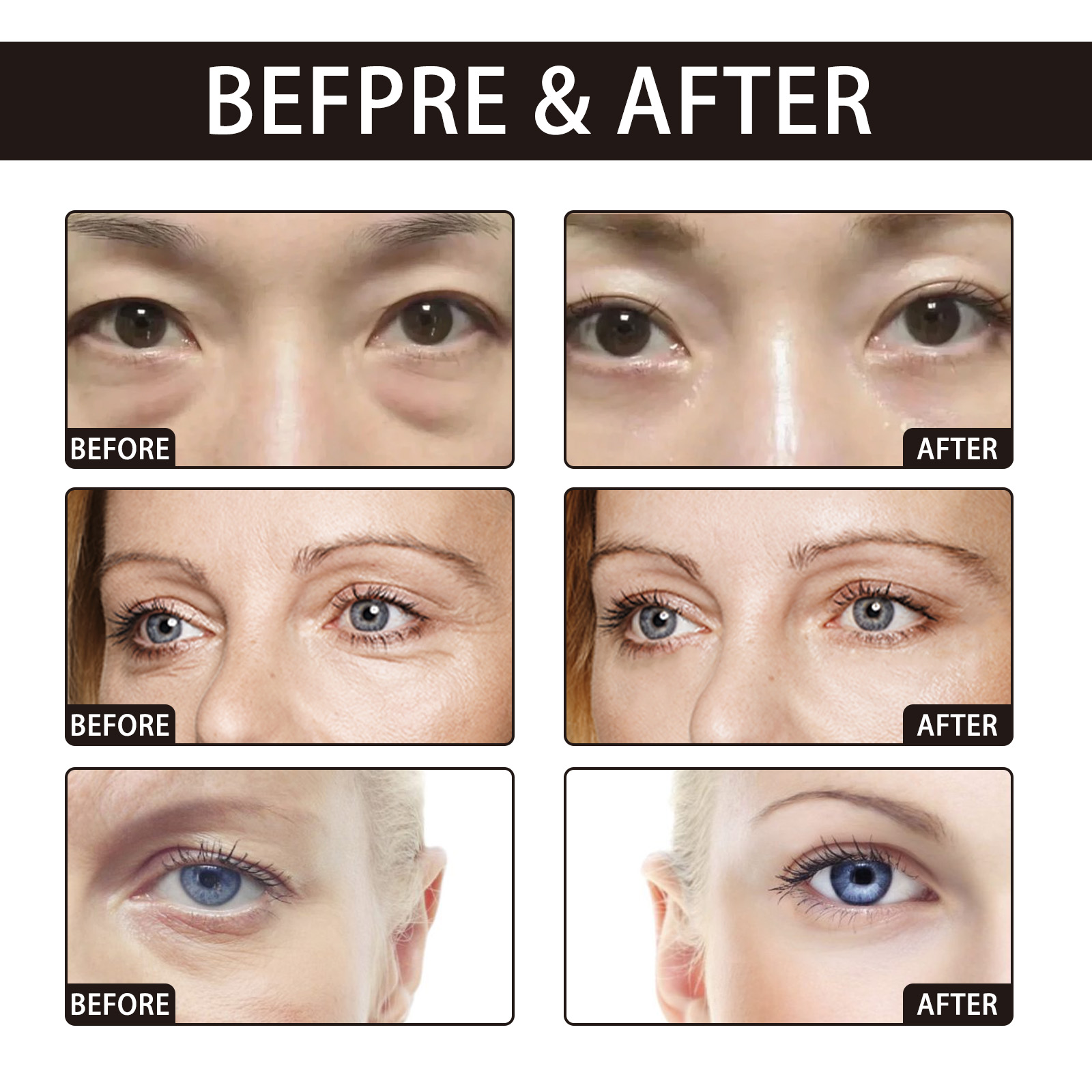 OUHOE Retinol Eye Cream Anti-W - đánh giá và giá Women Bags Under Eyes
